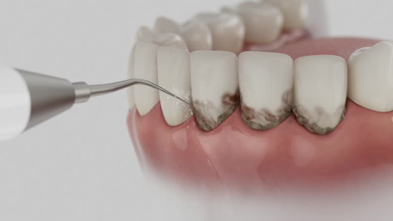 Reliable Root Canal Treatment contractor in Clark County County, OH by Dentist Open Now